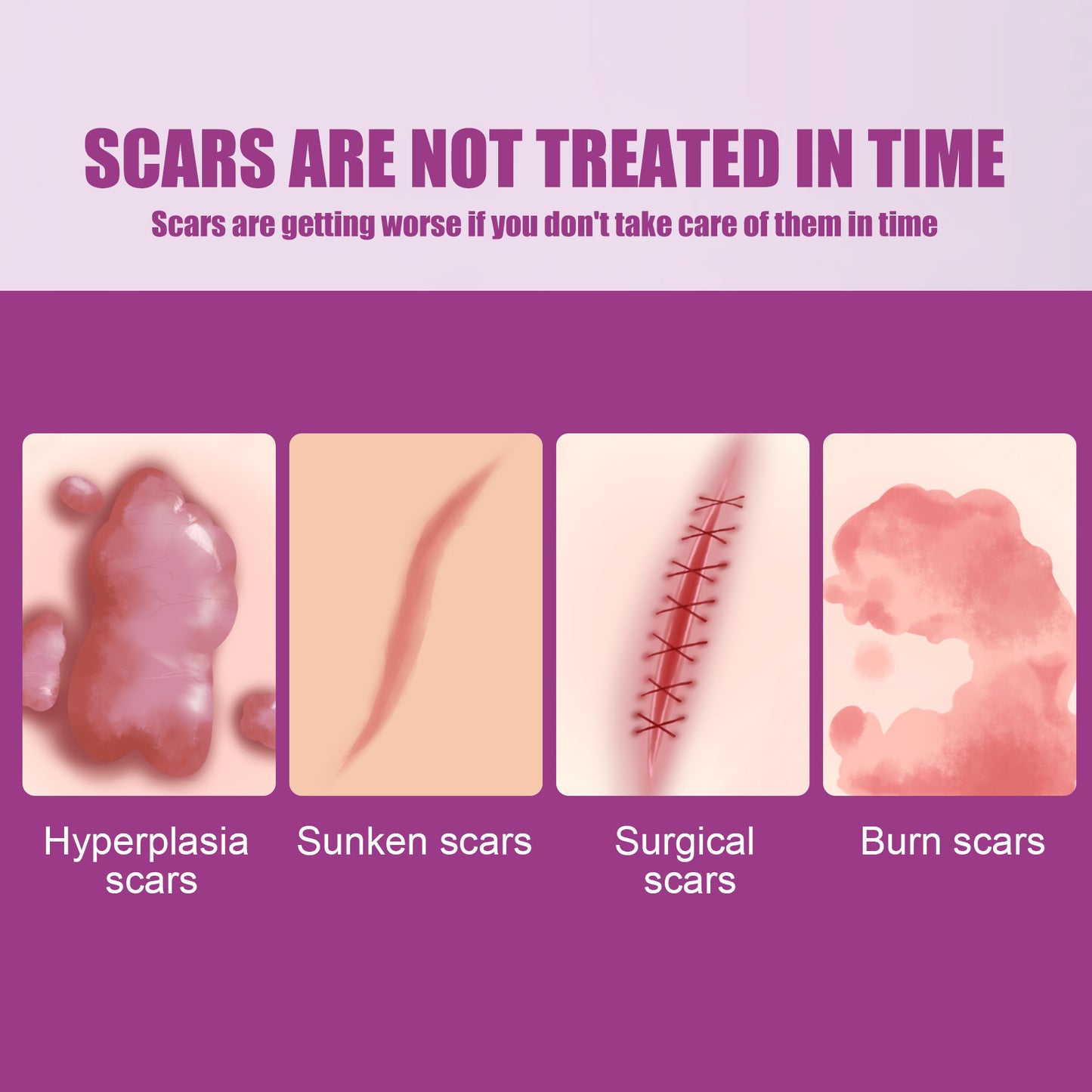 Hot Sale Scar Removing Cream Treating and Repair All Kinds of Old Scars