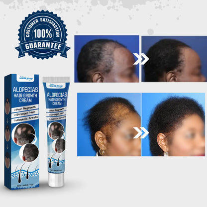 Alopecia Hair Growth Cream 100% proven working