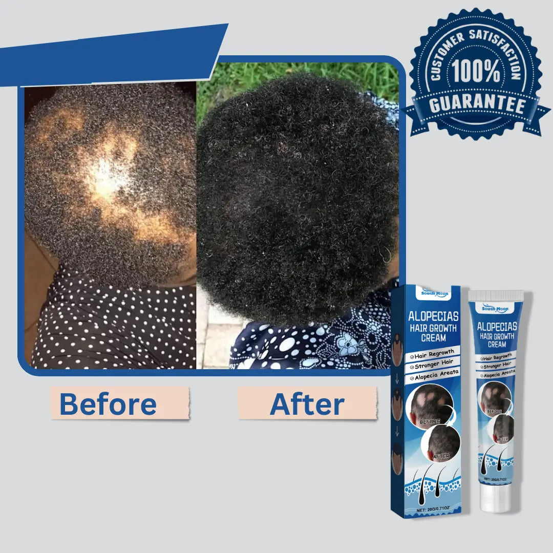 Alopecia Hair Growth Cream 100% proven working