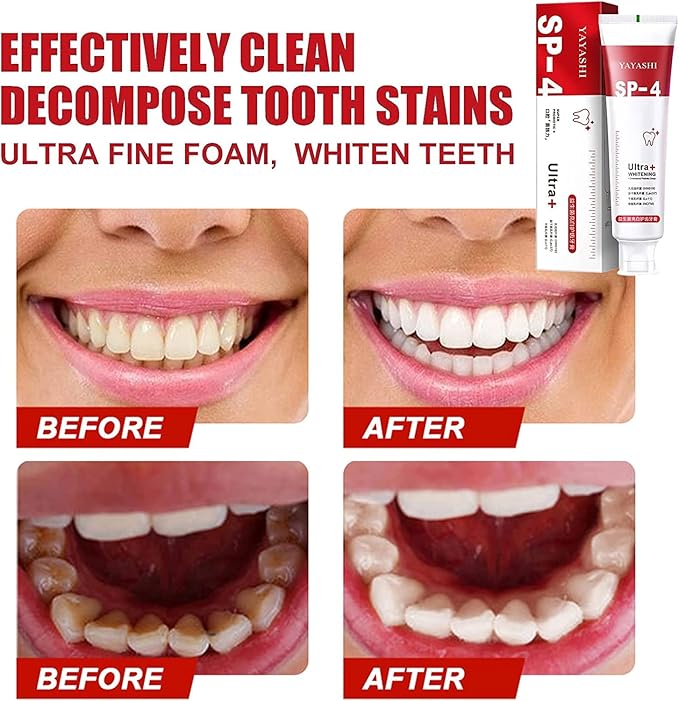 Sp-4 Probiotic  Ultra Whitening Toothpaste