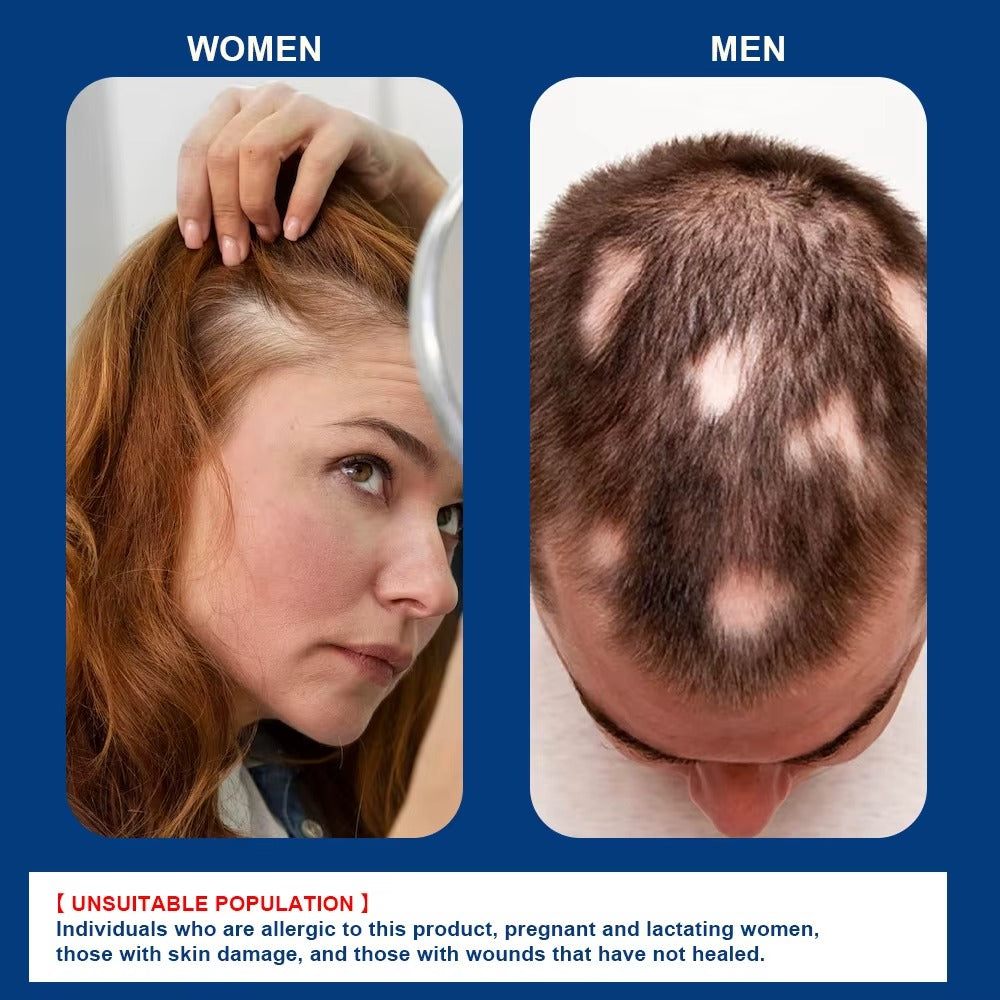 Alopecia Hair Growth Cream 100% proven working