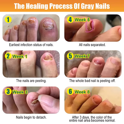 🦶 Kanyehb Fungal Nail Treatment – Restore Nail Health Naturally (Nail Repair)