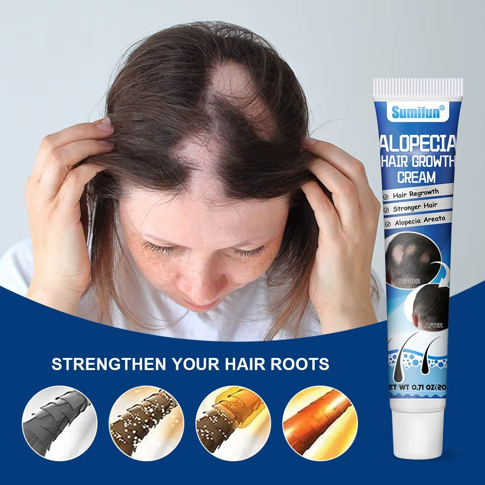 Alopecia Hair Growth Cream 100% proven working