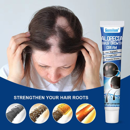 Alopecia Hair Growth Cream 100% proven working