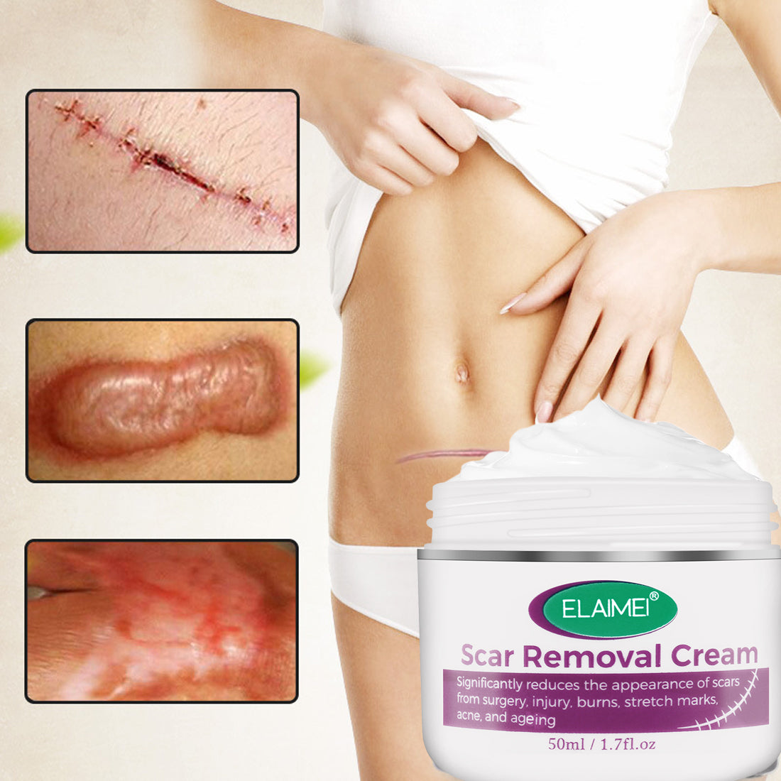Hot Sale Scar Removing Cream Treating and Repair All Kinds of Old Scars