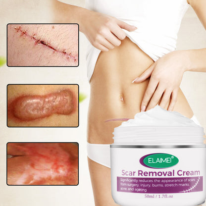 Hot Sale Scar Removing Cream Treating and Repair All Kinds of Old Scars