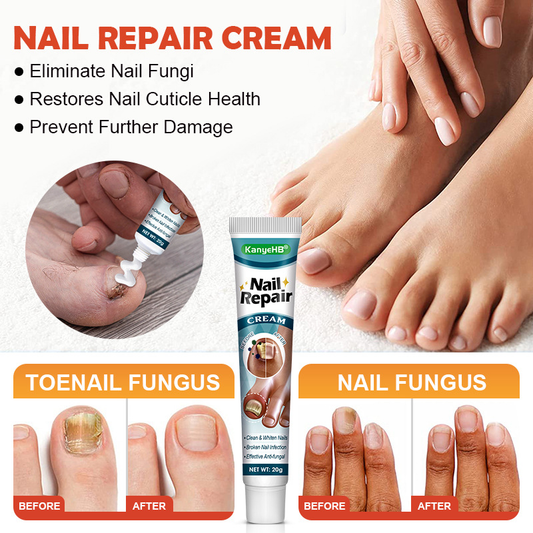 🦶 Kanyehb Fungal Nail Treatment – Restore Nail Health Naturally (Nail Repair)
