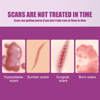 Hot Sale Scar Removing Cream Treating and Repair All Kinds of Old Scars