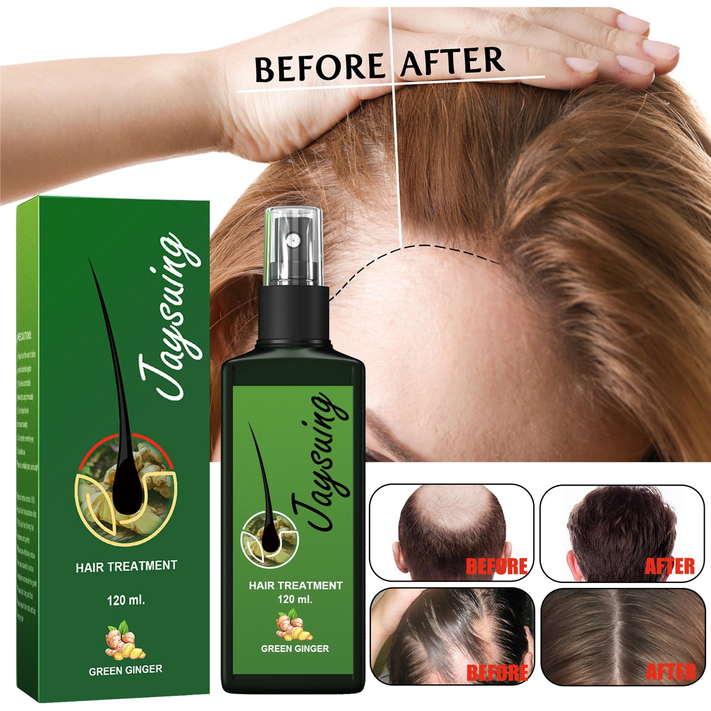 Hot Selling Hair Repair and Treatment Product Nourishing Roots Scalp Massage Hair Growth Spray 30ml 120ml