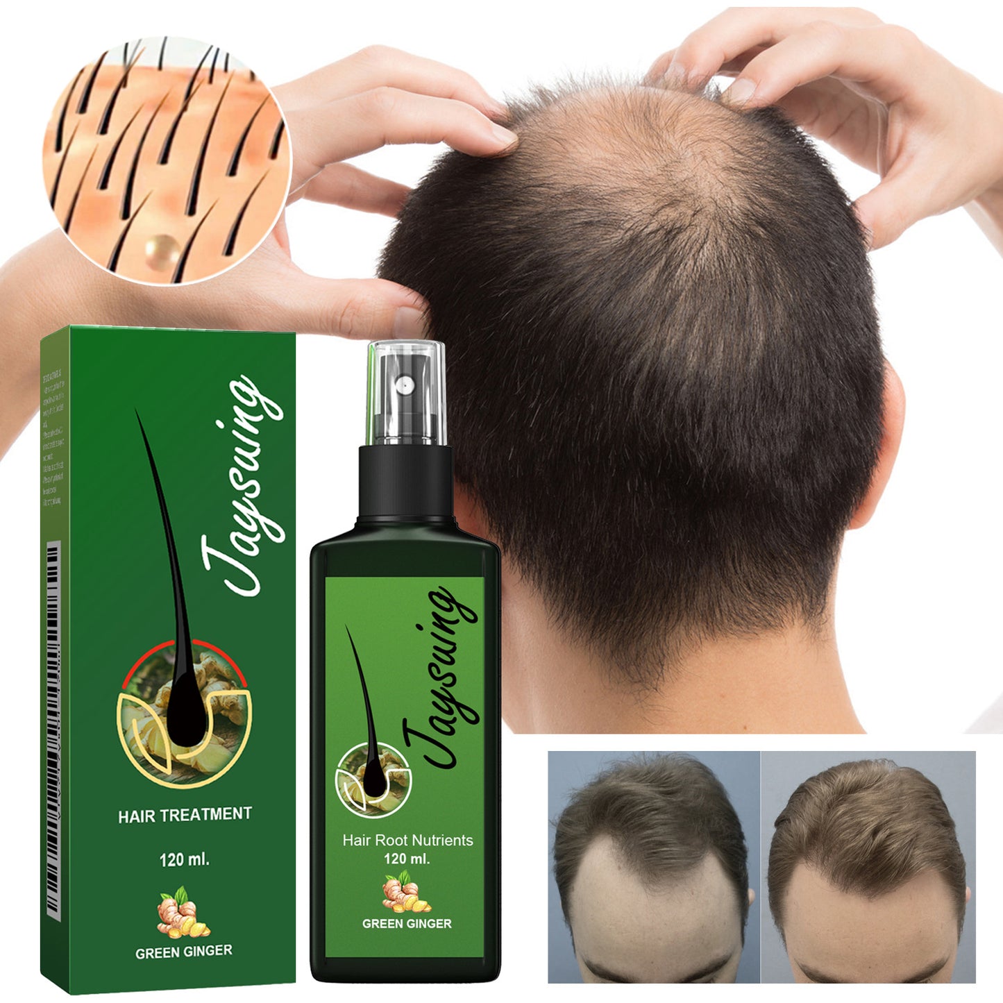 Hot Selling Hair Repair and Treatment Product Nourishing Roots Scalp Massage Hair Growth Spray 30ml 120ml