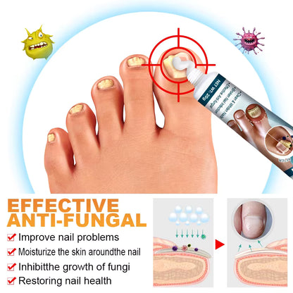 🦶 Kanyehb Fungal Nail Treatment – Restore Nail Health Naturally (Nail Repair)