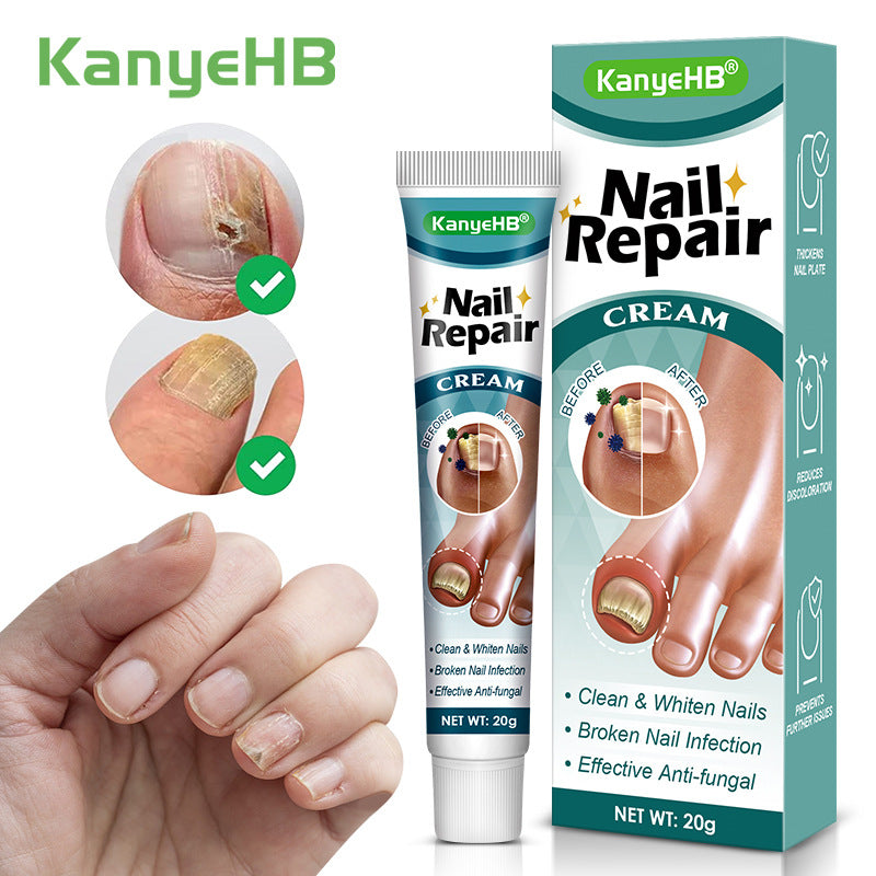 🦶 Kanyehb Fungal Nail Treatment – Restore Nail Health Naturally (Nail Repair)