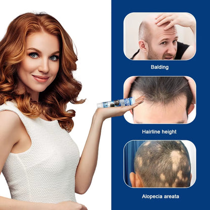 Alopecia Hair Growth Cream 100% proven working