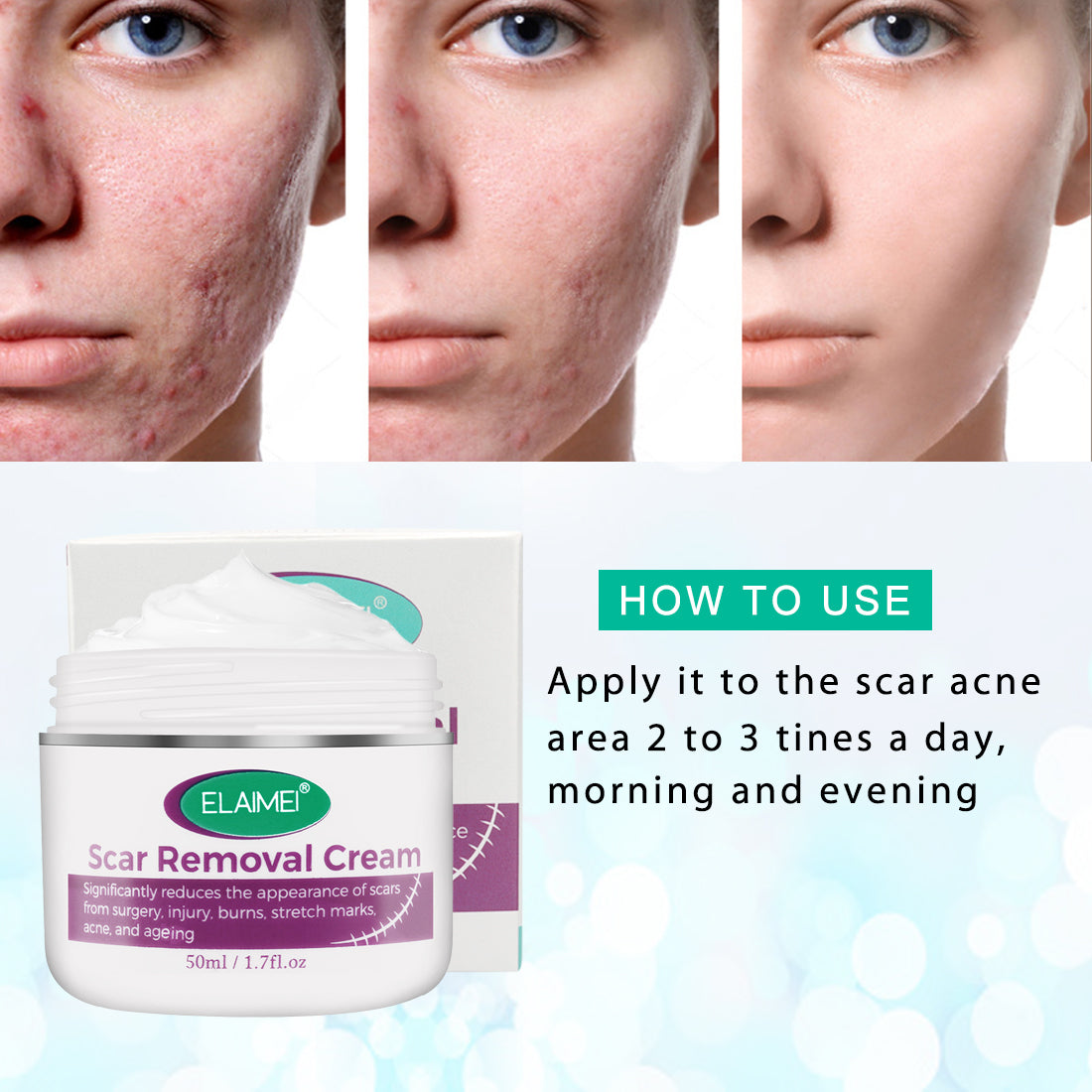 Hot Sale Scar Removing Cream Treating and Repair All Kinds of Old Scars