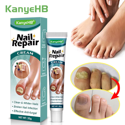 🦶 Kanyehb Fungal Nail Treatment – Restore Nail Health Naturally (Nail Repair)
