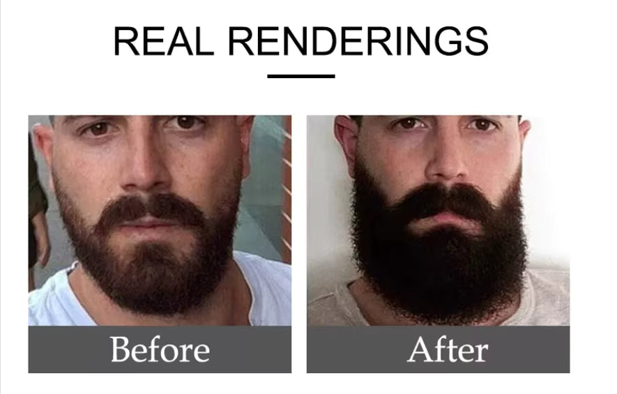 Natural Herbal Beard fast Growth Oil Nourishes and Smoothens Beard Made From Seeds