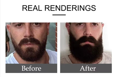 Natural Herbal Beard fast Growth Oil Nourishes and Smoothens Beard Made From Seeds