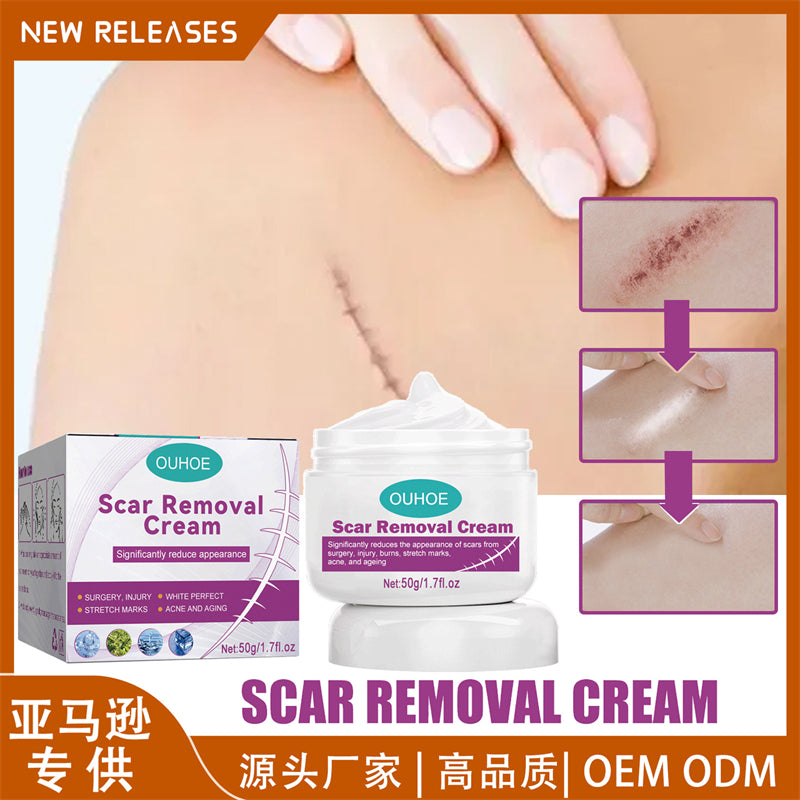 Hot Sale Scar Removing Cream Treating and Repair All Kinds of Old Scars