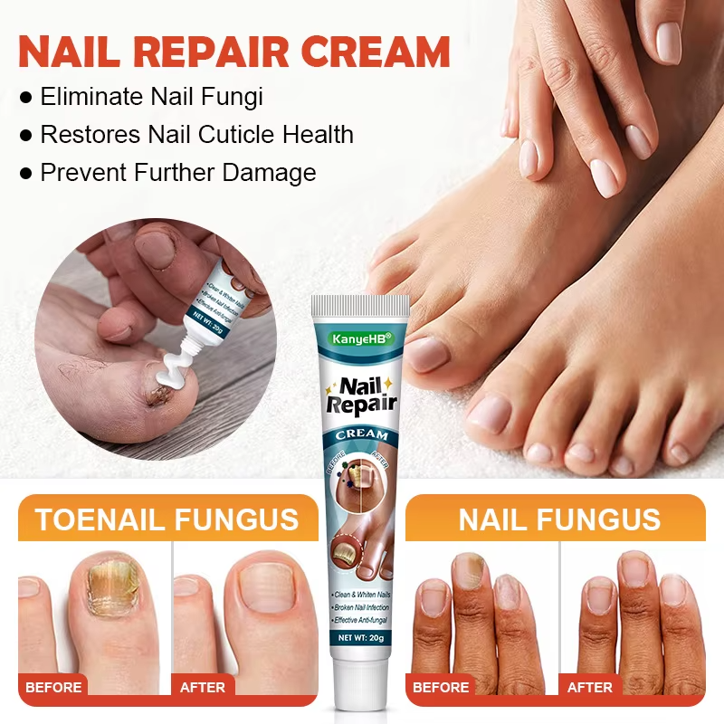 🦶 Kanyehb Fungal Nail Treatment – Restore Nail Health Naturally (Nail Repair)