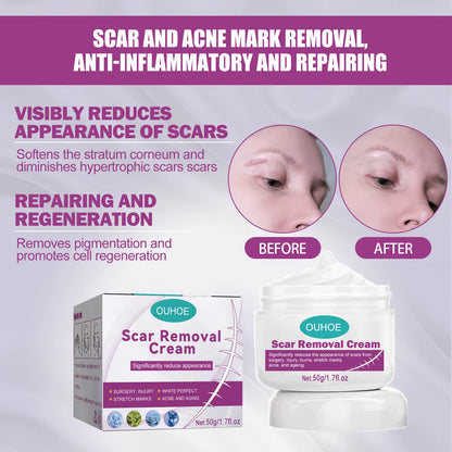 Hot Sale Scar Removing Cream Treating and Repair All Kinds of Old Scars