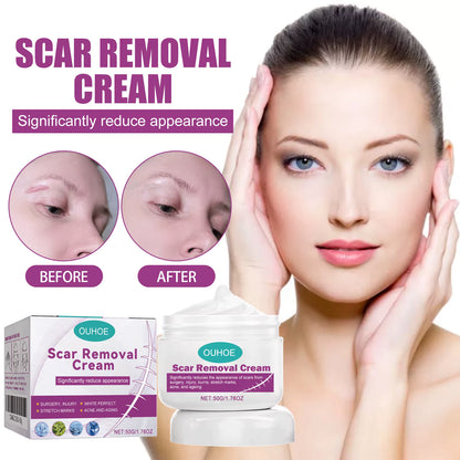 Hot Sale Scar Removing Cream Treating and Repair All Kinds of Old Scars